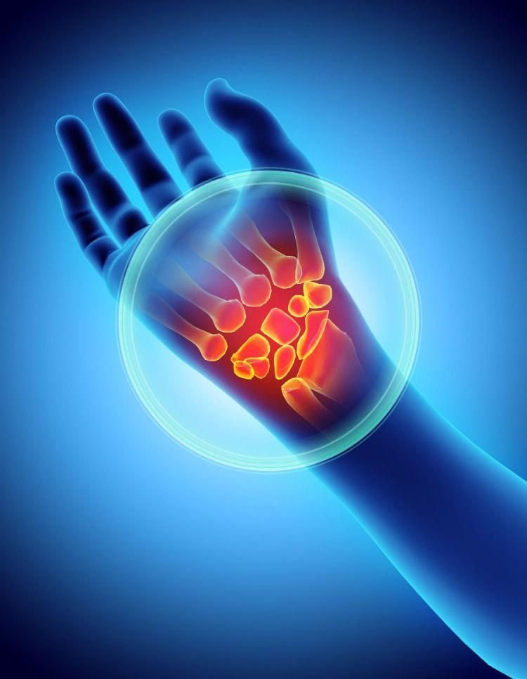 Neuro Physiotherapy Img